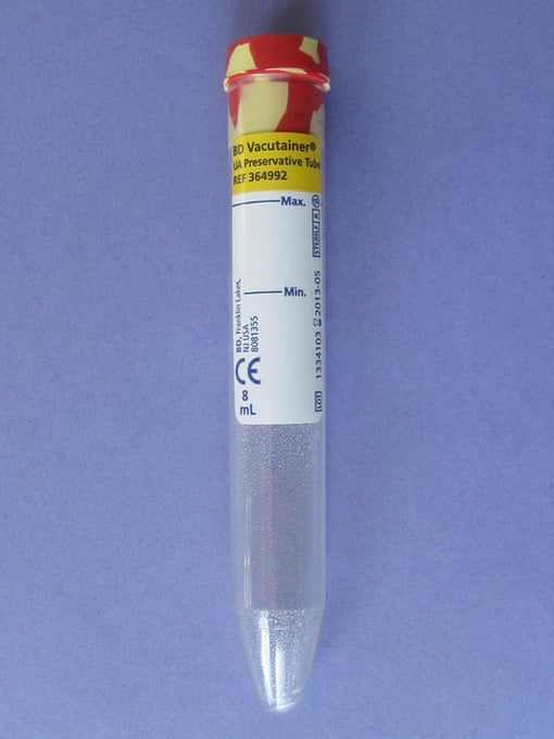 Vakuumrör urinprov propp konisk botten med tillsats rödgul propp