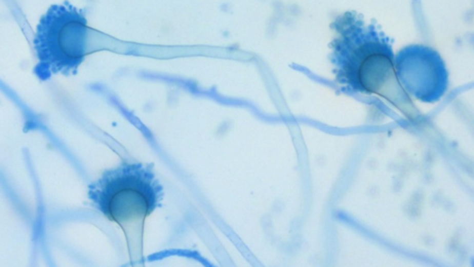 Mikroskopibild av svampen Aspergillus fumugatus